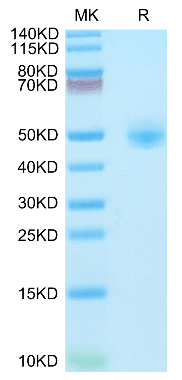 SDS-PAGE gel of Rhesus macaque CD4/LEU3 Protein 5170