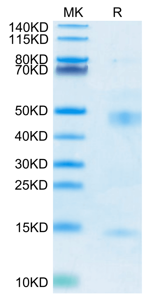 SDS-PAGE gel of Mouse Latent TGF beta 1/TGFB1 Protein 5198