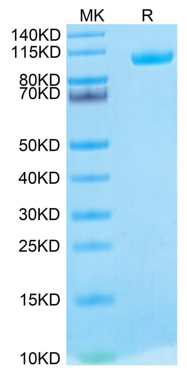 SDS-PAGE gel of Biotinylated Human MMP-9 Protein 5202