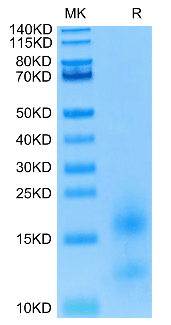 SDS-PAGE gel of Biotinylated Human BCMA/TNFRSF17 Protein 5209