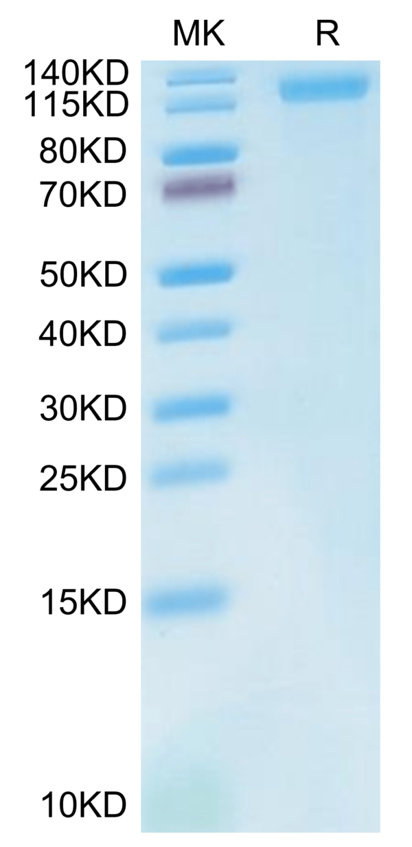 SDS-PAGE gel of Cynomolgus LDLR Protein 4273