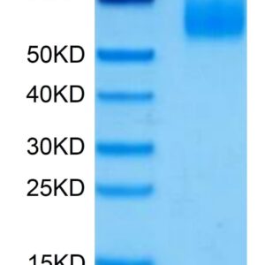 SDS-PAGE gel of Human Siglec-6/CD327 Protein 4572