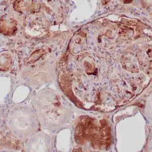 Immunohistochemistry (IHC) : Human transplanted kidney stained with anti-C3d antibody using  peroxidase-conjugate and DAB chromogen. Note basement membrane staining of renal tubules and glomeruli.