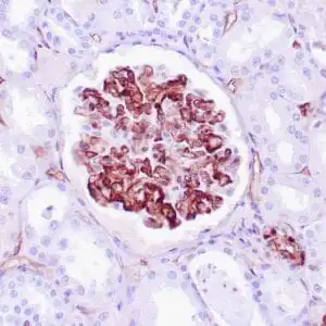 Immunohistochemistry (IHC) : Human rejected kidney stained with anti-C4d antibody using peroxidase-conjugate and DAB chromogen. Note basement membrane/cytoplasmic staining of renal tubules.