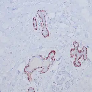 Immunohistochemistry (IHC) : Formalin-fixed, paraffin-embedded normal human breast tissue stained with anti-caldesmon antibody using peroxidase-conjugate and DAB chromogen. Note cytoplasmic staining of myoepithelial cells