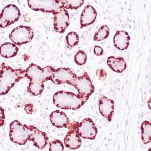 Immunohistochemistry (IHC) : Human normal breast tissue stained with anti-Calponin-1 antibody using peroxidase-conjugate and DAB chromogen. Note cytoplasmic staining of myoepithelial cells.