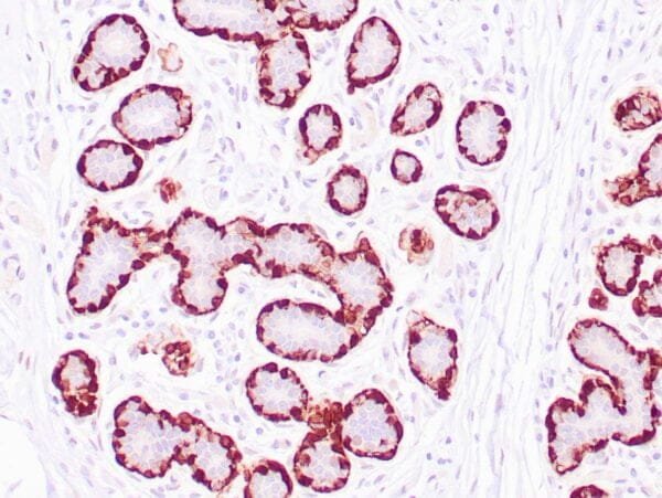 Immunohistochemistry (IHC) : Human normal breast tissue stained with anti-Calponin-1 antibody using peroxidase-conjugate and DAB chromogen. Note cytoplasmic staining of myoepithelial cells.