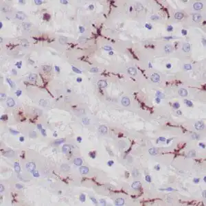 Immunohistochemistry (IHC) : Formalin-fixed, paraffin-embedded human liver stained with anti-CD10 antibody using  peroxidase-conjugate and DAB chromogen. Note the canalicular staining of hepatocytes