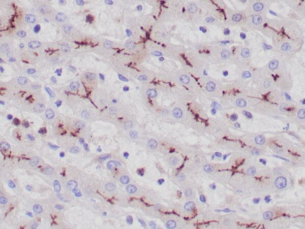 Immunohistochemistry (IHC) : Formalin-fixed, paraffin-embedded human liver stained with anti-CD10 antibody using  peroxidase-conjugate and DAB chromogen. Note the canalicular staining of hepatocytes