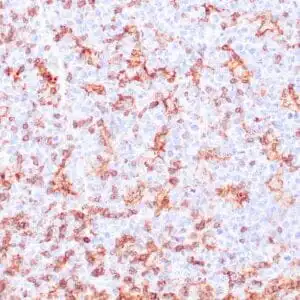 Immunohistochemistry (IHC) : Human tonsil stained with anti-CD11c antibody using peroxidase-conjugate and DAB chromogen. Note strong membranous staining of lymphocytes.