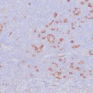 Immunohistochemistry (IHC) : Human tonsil stained with anti-CD123 antibody using peroxidase-conjugate and DAB chromogen. Note the cytoplasmic staining of plasmacytoid dendritic cells.