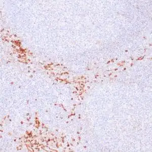 Immunohistochemistry (IHC) : Human tonsil stained with anti-CD123 antibody using peroxidase-conjugate and DAB chromogen. Note the cytoplasmic staining of plasmacytoid dendritic cells.
