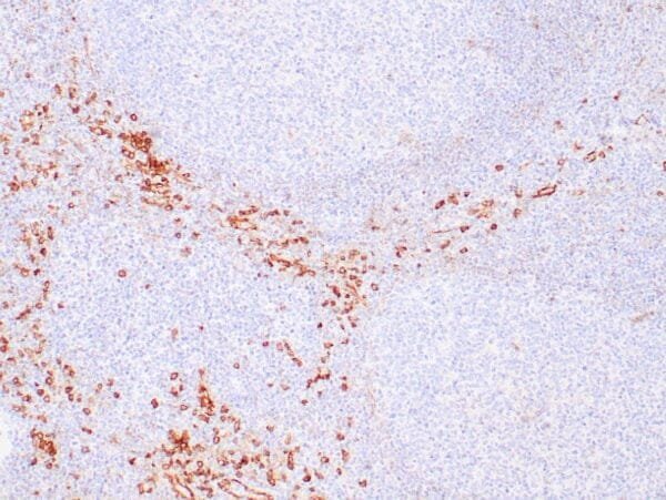 Immunohistochemistry (IHC) : Human tonsil stained with anti-CD123 antibody using peroxidase-conjugate and DAB chromogen. Note the cytoplasmic staining of plasmacytoid dendritic cells.