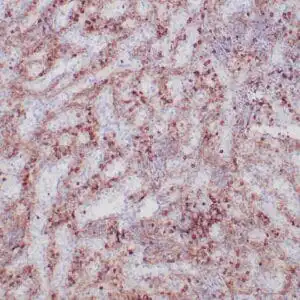 Immunohistochemistry (IHC) : Human spleen stained with anti-CD13 antibody using peroxidase-conjugate and DAB chromogen. Note cytoplasmic staining of myeloid cells.