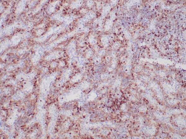 Immunohistochemistry (IHC) : Human spleen stained with anti-CD13 antibody using peroxidase-conjugate and DAB chromogen. Note cytoplasmic staining of myeloid cells.