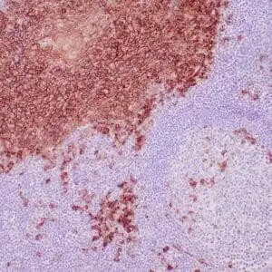Immunohistochemistry (IHC) : Formalin-fixed, paraffin-embedded human tonsil stained with anti-CD138 antibody using peroxidase-conjugate and DAB chromogen. Note the cytoplasmic staining of plasma cells and squamous epithelium