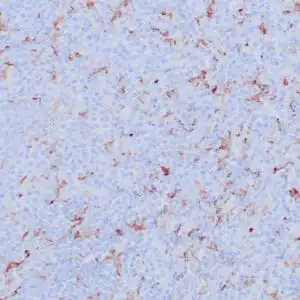 Immunohistochemistry (IHC) : Human lymph node stained with anti-CD163 antibody using peroxidase-conjugate and DAB chromogen. Note membrane staining of histiocytes.
