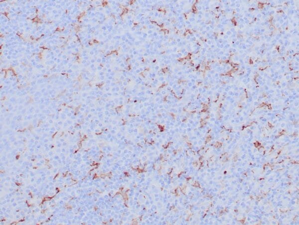 Immunohistochemistry (IHC) : Human lymph node stained with anti-CD163 antibody using peroxidase-conjugate and DAB chromogen. Note membrane staining of histiocytes.