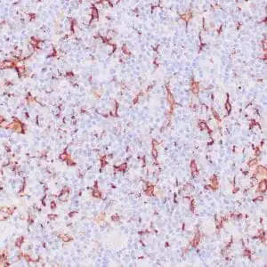 Immunohistochemistry (IHC) : Human lymph node stained with anti-CD163 antibody using peroxidase-conjugate and DAB chromogen. Note membrane staining of histiocytes.