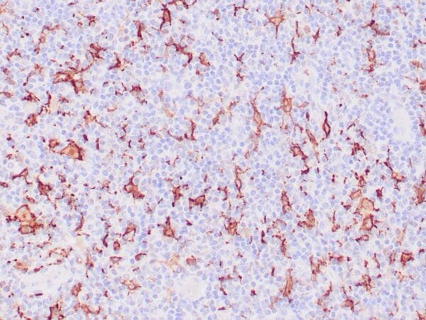 Immunohistochemistry (IHC) : Human lymph node stained with anti-CD163 antibody using peroxidase-conjugate and DAB chromogen. Note membrane staining of histiocytes.