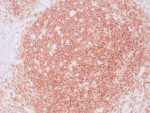 Immunohistochemistry (IHC) : Human tonsil stained with anti-CD19 antibody using peroxidase-conjugate and DAB chromogen. Note the membranous staining of B-cells .