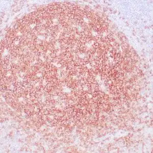 Immunohistochemistry (IHC) : Human tonsil stained with anti-CD19 antibody using peroxidase-conjugate and DAB chromogen. Note the membranous staining of B-cells .