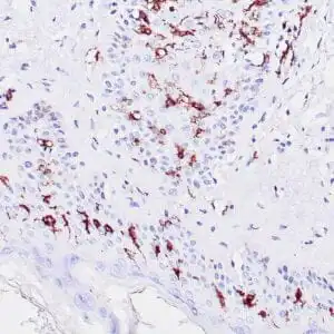 Immunohistochemistry (IHC) : Human skin stained with anti-CD1a antibody using peroxidase-conjugate and DAB chromogen. Note membrane staining of langerhan cells.