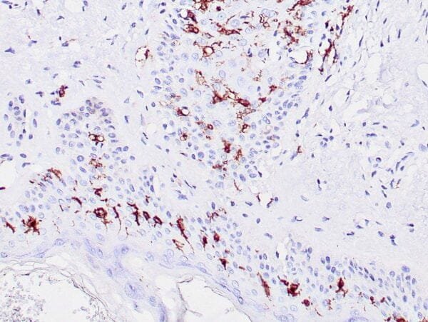 Immunohistochemistry (IHC) : Human skin stained with anti-CD1a antibody using peroxidase-conjugate and DAB chromogen. Note membrane staining of langerhan cells.