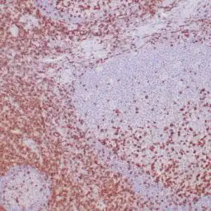 Immunohistochemistry (IHC) : Formalin-fixed, paraffin-embedded human tonsil stained with anti-CD2 antibody using peroxidase-conjugate and DAB chromogen. Note membrane and cytoplasmic staining of perifollicular T cells