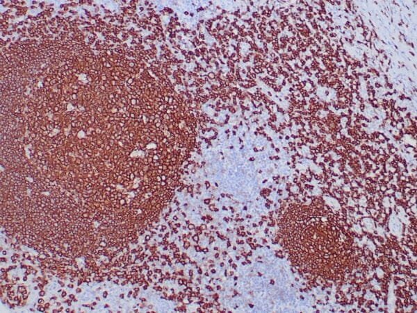 Immunohistochemistry (IHC) : Formalin-fixed, paraffin-embedded human lymph node stained with anti-CD20 antibody using peroxidase-conjugate and DAB chromogen. Note cell surface staining of B-cells.