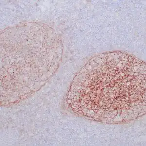 Immunohistochemistry (IHC) : Formalin-fixed, paraffin-embedded human tonsil stained with anti-CD21 antibody using peroxidase-conjugate and DAB chromogen. Note the membrane staining of follicular dendritic cells