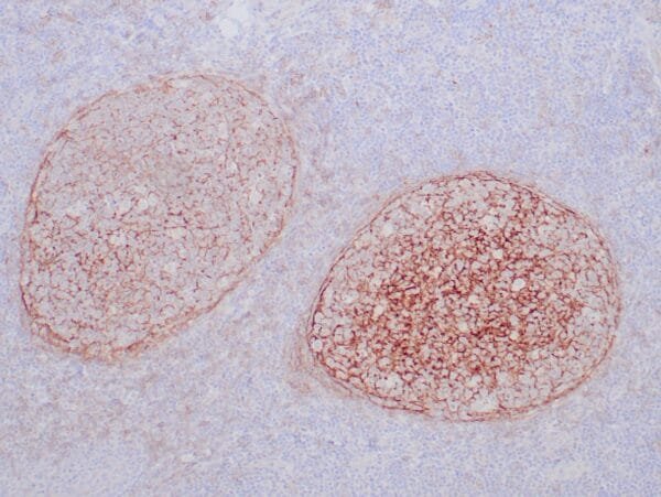 Immunohistochemistry (IHC) : Formalin-fixed, paraffin-embedded human tonsil stained with anti-CD21 antibody using peroxidase-conjugate and DAB chromogen. Note the membrane staining of follicular dendritic cells