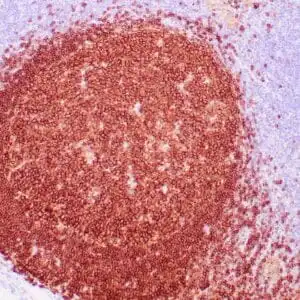 Immunohistochemistry (IHC) : Human spleen stained with anti-CD22 antibody using peroxidase-conjugate and DAB chromogen. Note cytoplasmic staining of B-lymphocytes.