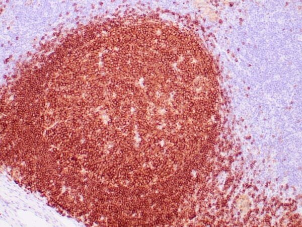 Immunohistochemistry (IHC) : Human spleen stained with anti-CD22 antibody using peroxidase-conjugate and DAB chromogen. Note cytoplasmic staining of B-lymphocytes.