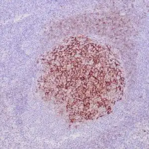Immunohistochemistry (IHC) : Formalin-fixed, paraffin-embedded human tonsil stained with anti-CD23 antibody using peroxidase-conjugate and DAB chromogen. Note the membranous staining of follicular dendritic cells