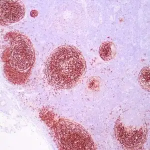 Immunohistochemistry (IHC) : Human tonsil stained with anti-CD23 antibody using peroxidase-conjugate and DAB chromogen. Note the membranous staining of follicular dendritic cells.