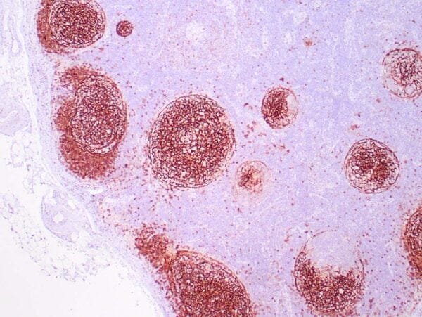 Immunohistochemistry (IHC) : Human tonsil stained with anti-CD23 antibody using peroxidase-conjugate and DAB chromogen. Note the membranous staining of follicular dendritic cells.