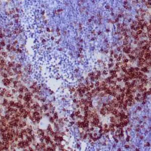 Immunohistochemistry (IHC) : Formalin-Fixed, paraffin-embedded human thymus stained with anti-CD27 antibody using peroxidase-conjugate and DAB chromogen. Note the cell surface staining of medullary T cells