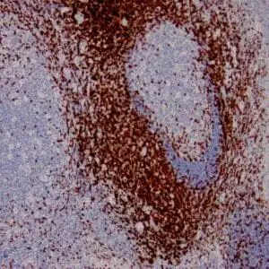 Immunohistochemistry (IHC) : Formalin-fixed, paraffin-embedded human lymph node stained with anti-CD3 antibody using peroxidase-conjugate and DAB chromogen. Note the membranous staining of perifollicular T-cells and no stain in B-cells