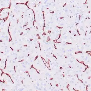 Immunohistochemistry (IHC) : Human thyroid tissue stained with anti-CD34 antibody using peroxidase-conjugate and DAB chromogen. Note the cytoplasmic staining of vascular endothelial cells.