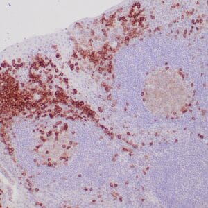 Immunohistochemistry (IHC) : Human tonsil stained with anti-CD38 antibody using peroxidase-conjugate and DAB chromogen. Note cytoplasmic staining of perifollicular and subepithelial plasma cells.