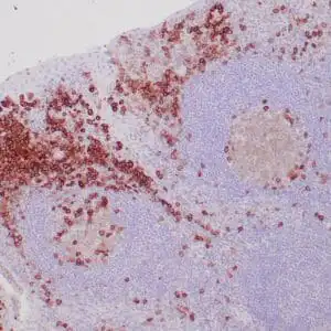 Immunohistochemistry (IHC) : Human tonsil stained with anti-CD38 antibody using peroxidase-conjugate and DAB chromogen. Note cytoplasmic staining of perifollicular and subepithelial plasma cells.
