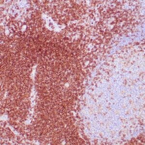 Immunohistochemistry (IHC) : Human tonsil stained with anti-CD4 using peroxidase-conjugate and DAB chromogen. Note cell membrane staining of T cells cells.