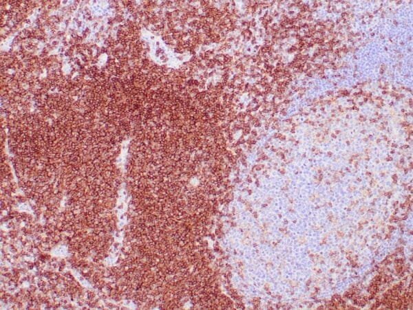 Immunohistochemistry (IHC) : Human tonsil stained with anti-CD4 using peroxidase-conjugate and DAB chromogen. Note cell membrane staining of T cells cells.