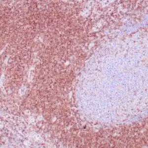 Immunohistochemistry (IHC) : Human tonsil stained with anti-CD4 using peroxidase-conjugate and DAB chromogen. Note cell membrane staining of T cells.