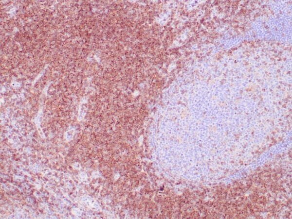 Immunohistochemistry (IHC) : Human tonsil stained with anti-CD4 using peroxidase-conjugate and DAB chromogen. Note cell membrane staining of T cells.