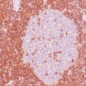 Immunohistochemistry (IHC) : Human lymph node stained with anti-CD43 antibody using peroxidase-conjugate and DAB chromogen. Note the cell membrane staining of perifollicular T-cells.