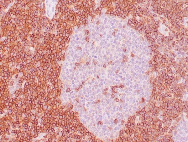 Immunohistochemistry (IHC) : Human lymph node stained with anti-CD43 antibody using peroxidase-conjugate and DAB chromogen. Note the cell membrane staining of perifollicular T-cells.