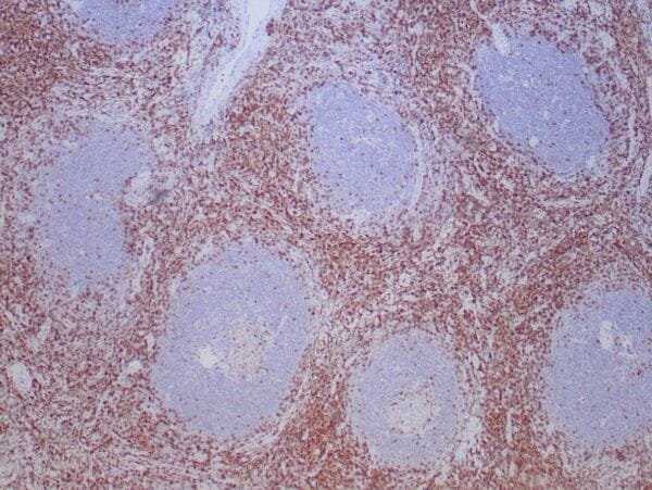 Immunohistochemistry (IHC) : Formalin-fixed, paraffin-embedded human tonsil stained with anti-CD43 antibody using peroxidase-conjugate and DAB chromogen. Note the cell membrane staining of perifollicular T-cells