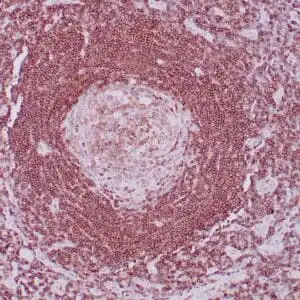 Immunohistochemistry (IHC) : Formalin-fixed, paraffin-embedded human lymph node stained with anti-CD45RA antibody using peroxidase- conjugate and DAB chromogen. Note the membrane staining of B-cells in mantle (strong) and in follicle (weak)